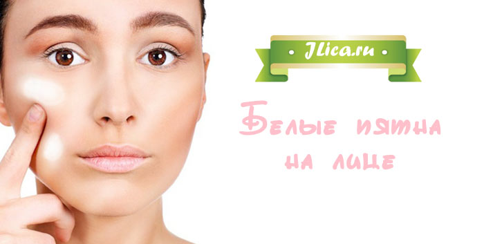 10 лучших средств от пигментных пятен на лице — народный рейтинг