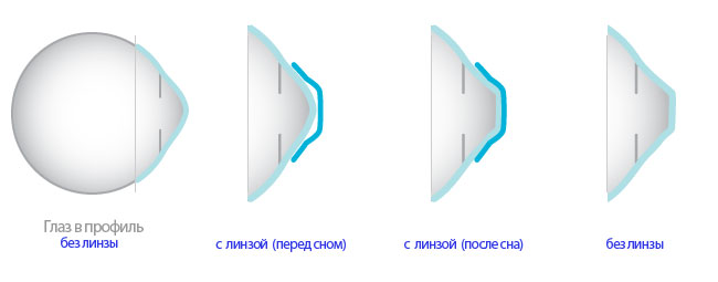8 лучших растворов для линз — народный рейтинг
