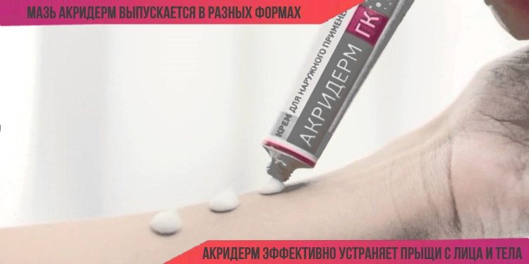 Акридерм от прыщей: свойства, показания и противопоказания