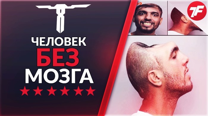Человек, живущий без мозга – невероятно, но факт