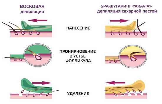 Депилятор и эпилятор: в чем разница, что лучше