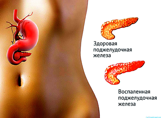 Гарвардскими специалистами создана искусственная поджелудочная железа
