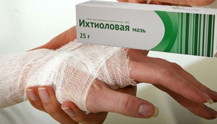 Ихтиоловая мазь: способ применения и дозировка