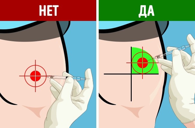 Как делать укол в ягодицу – самая подробная инструкция