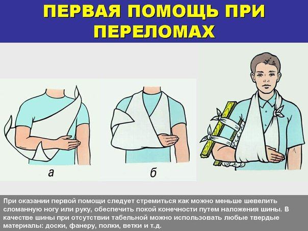 Как оказывается первая помощь при переломе руки?