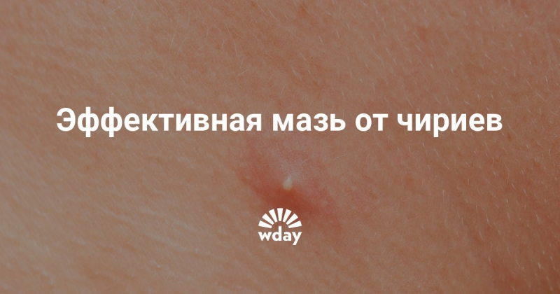 Какая мазь от чириев наиболее эффективна: обзор наиболее лучших средств