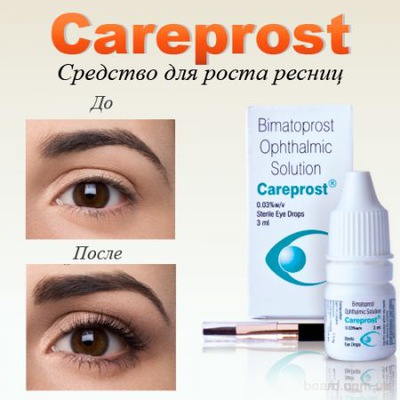 Карепрост (careprost) для роста ресниц, отзывы врачей, покупать ли ?