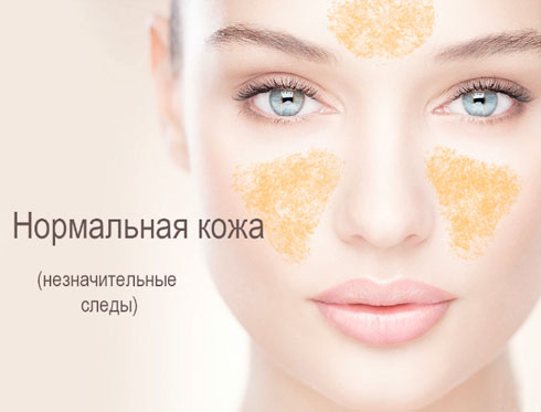 Картофельный сок для лица: результативный классический метод