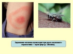 Описание и фото мухи цеце