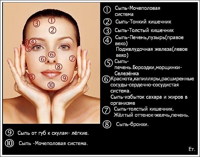 От каких продуктов появляются прыщи на лице и теле