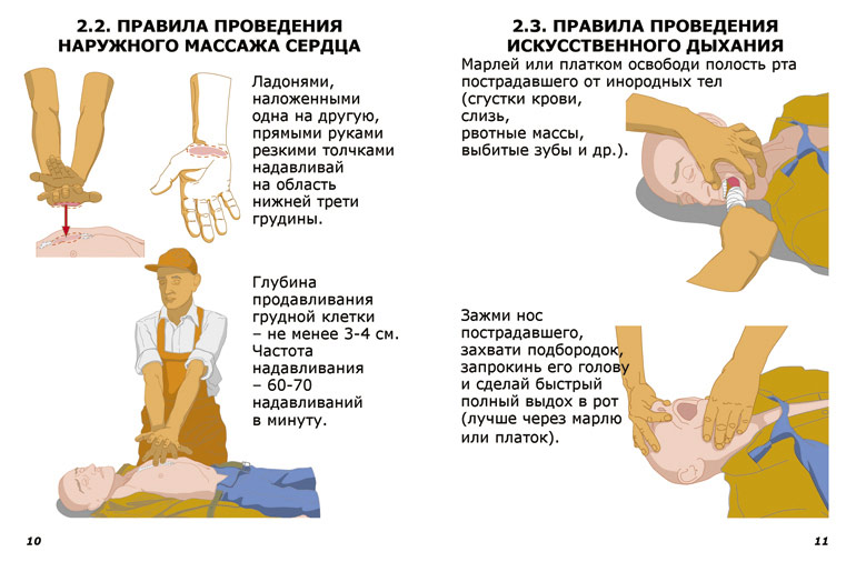 Первая помощь при остановке сердца: основные методы и техники