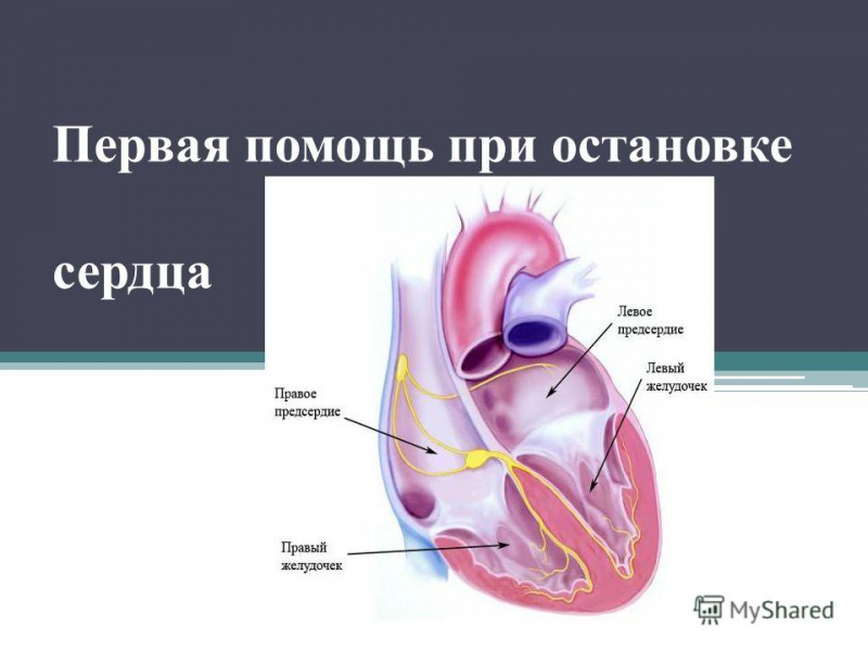 Первая помощь при остановке сердца: основные методы и техники