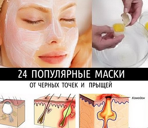 Сода от черных точек: популярные рецепты скраба и масок